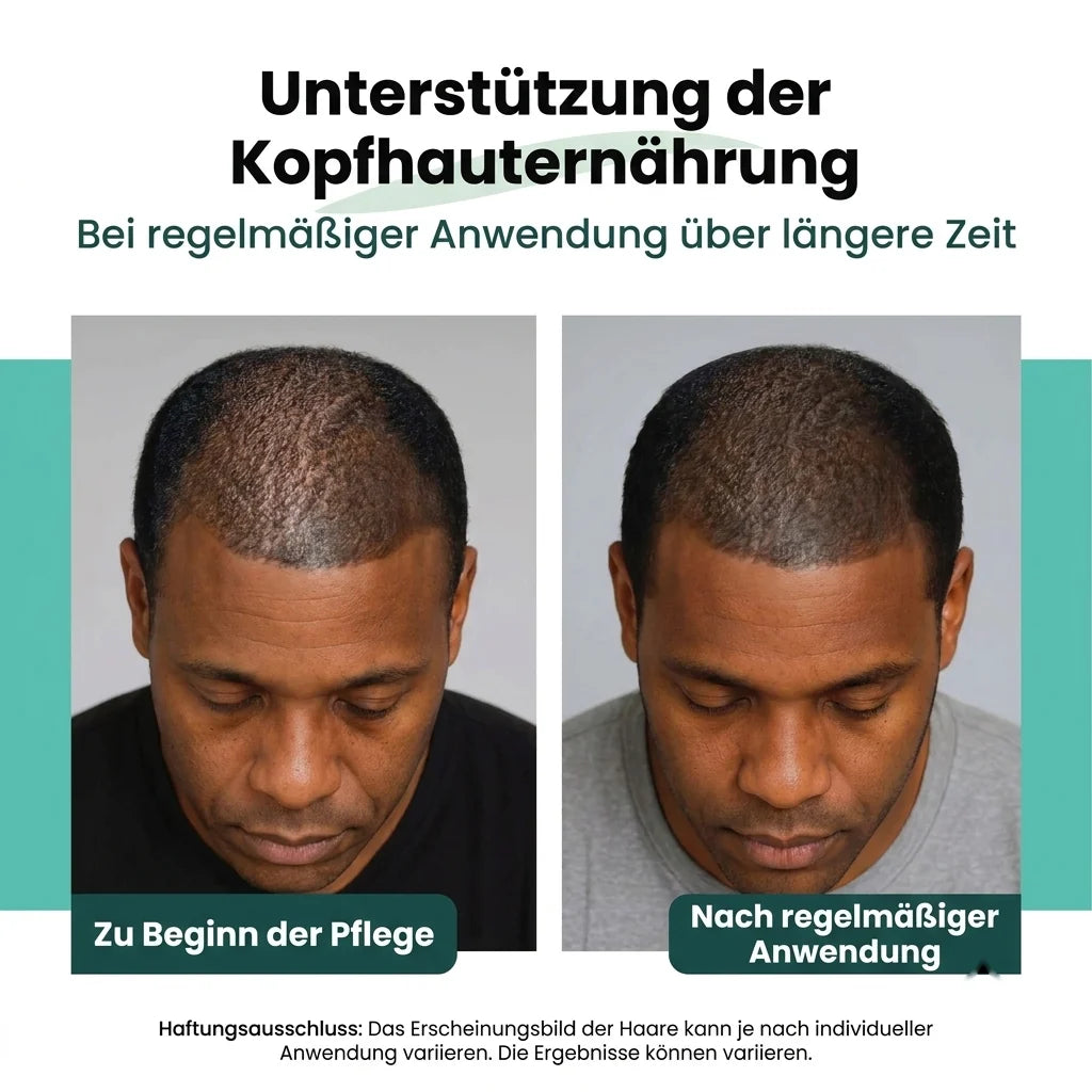BeepWell Batana Öl gegen Haarausfall und trockenes Haar